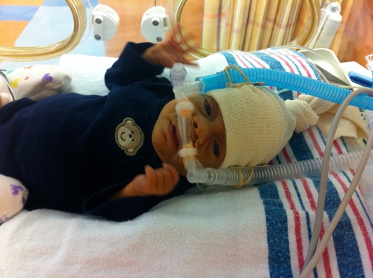 Preemie Benjamin in hospital on cpap